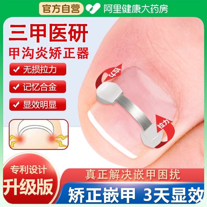 甲沟嵌甲矫正器正甲贴片脚v趾指甲往肉里长专用矫正器片指甲扎肉
