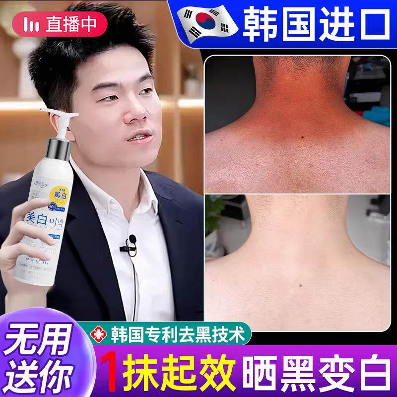 太阳晒黑修复快速军训晒后修复专用晒伤脖子脸男士