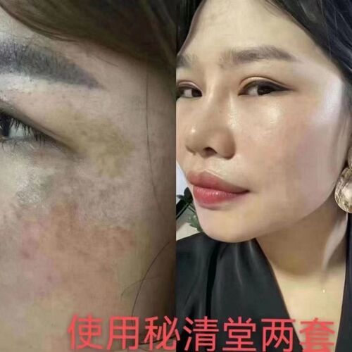 净肤套装