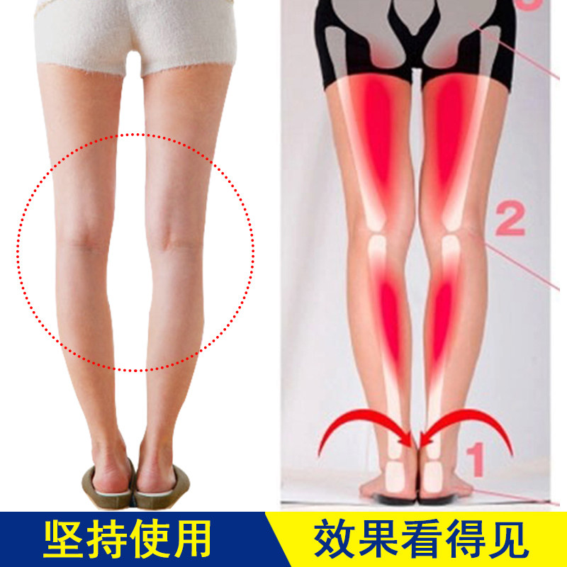 成人O型腿矫正鞋垫女式足内翻矫正器扁平足纠正鞋垫罗.圈腿校正男