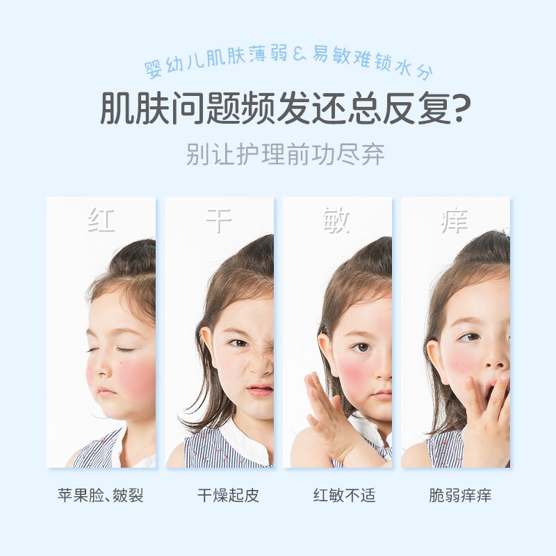 芮洣舒大白精华霜婴幼新生儿童特护面霜舒缓保湿宝宝润肤滋润补水