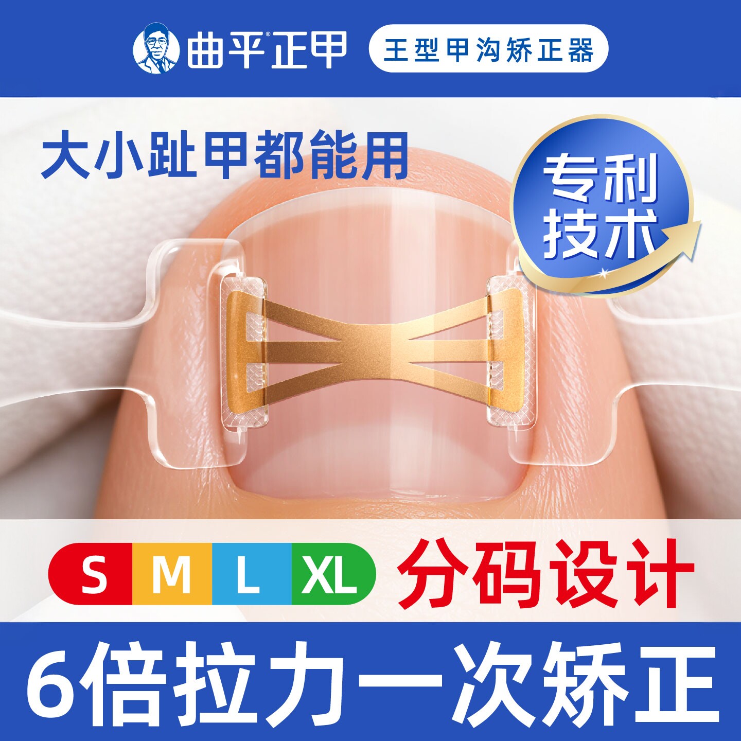 曲平正甲甲沟嵌甲指甲矫正器炎正甲贴片医生脚趾甲盖扎肉足科专用