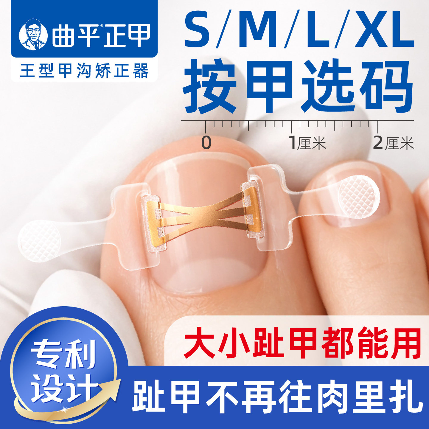 曲平正甲甲沟嵌甲指甲矫正器炎正甲贴片医生脚趾甲盖扎肉足科专用