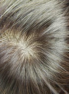 顺心假发真发丝女式头顶假发片直发片遮挡白发卷发片