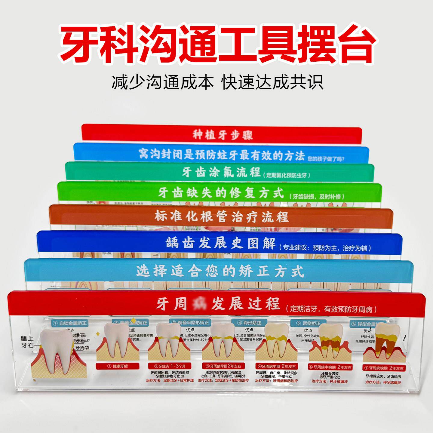 牙科沟通工具口腔医院医患讲解标识摆台根管治疗种植牙流程定制做