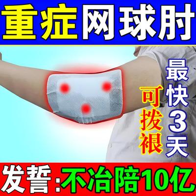 网球肘专用药药膏克星治疗特效重症胳膊手肘关节疼痛护肘狸米凝胶