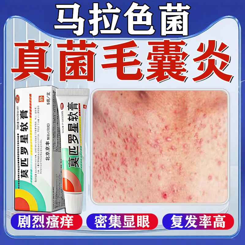 莫匹罗星正品软膏官方马拉色菌毛囊炎专用药背后长痘痘后背毛囊炎