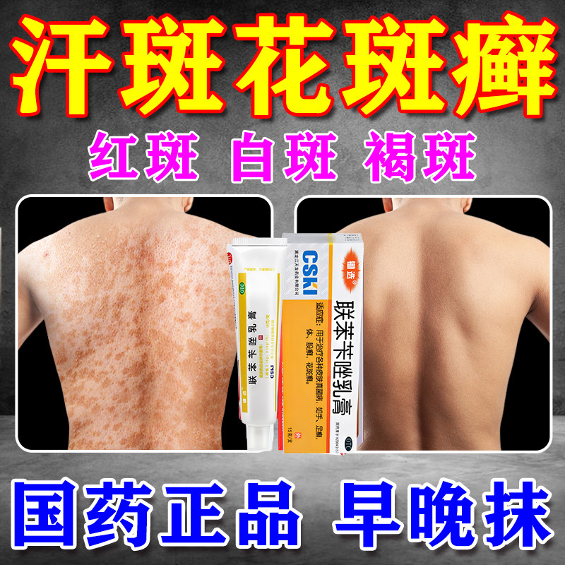 联苯苄唑乳膏正品软膏官方旗舰店汗斑专用药汗斑花斑专用特新效药