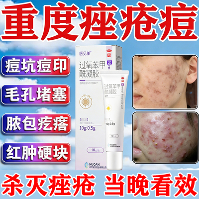 【明必欣】过氧苯甲酰凝胶10g*1支/盒