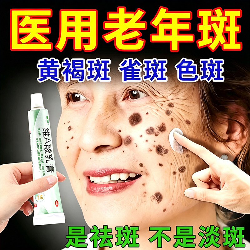 维a酸乳膏去老年斑医用官方旗舰店淡化黑色素去老年斑特新效期药