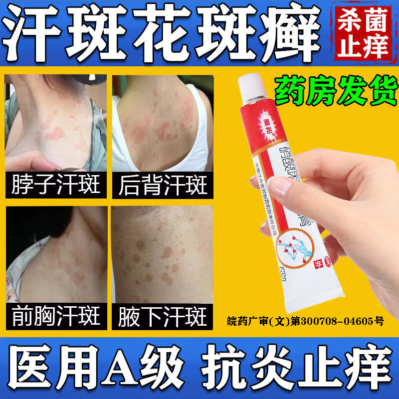 硝酸咪康唑乳膏正品官方汗斑花斑癣专用药膏特药效医用级皮肤癣痒