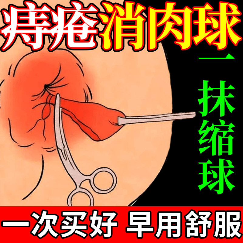 华中医排行榜郎痔疮凝胶药膏第一名痔疮根药消肉球断芝芳爽痔疮膏