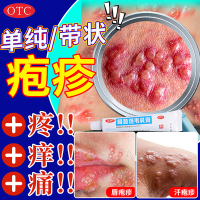 【太平】阿昔洛韦乳膏3%*10g*1支/盒