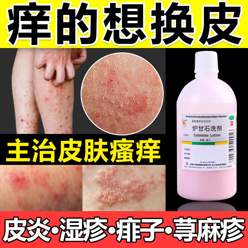 炉甘石湿疹止痒去看根炉甘石洗剂外用湿疹止痒真菌感染止痒湿疹S2