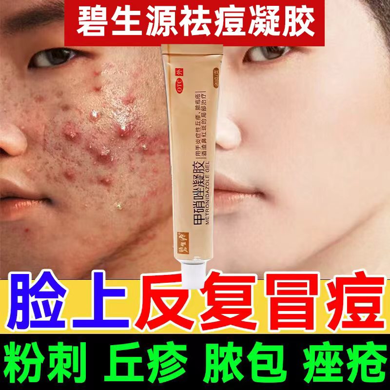 【碧生源】甲硝唑凝胶0.75%*20g*1支/盒