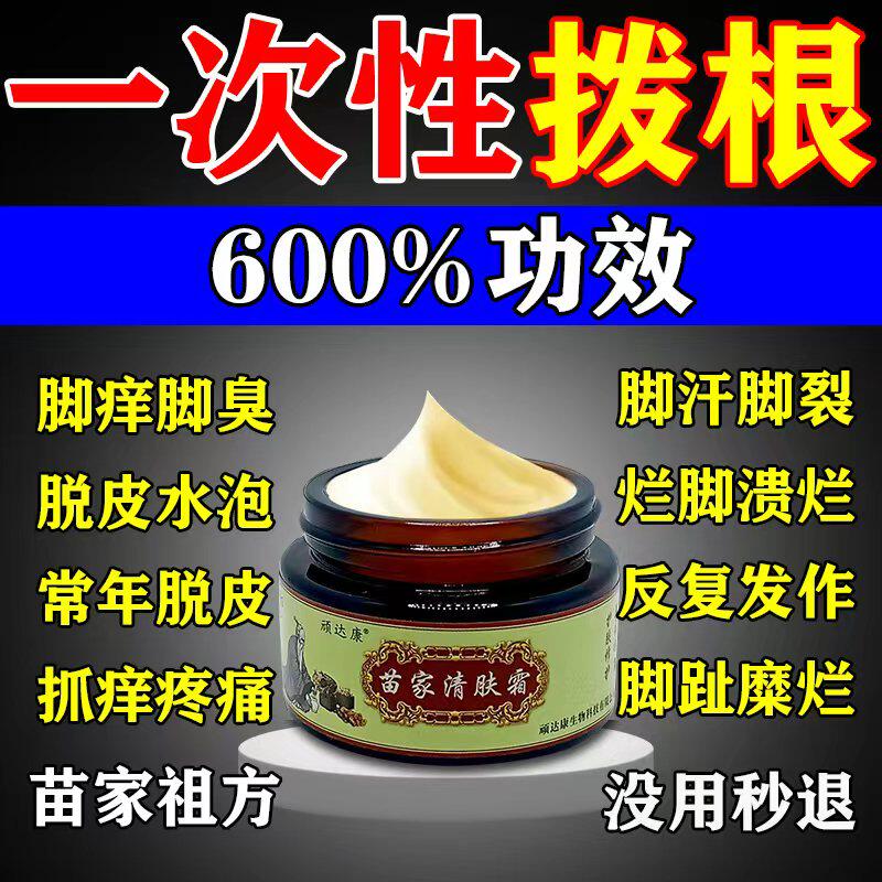 苗家祖方脚膏止痒去气根真菌感染膏26.3元