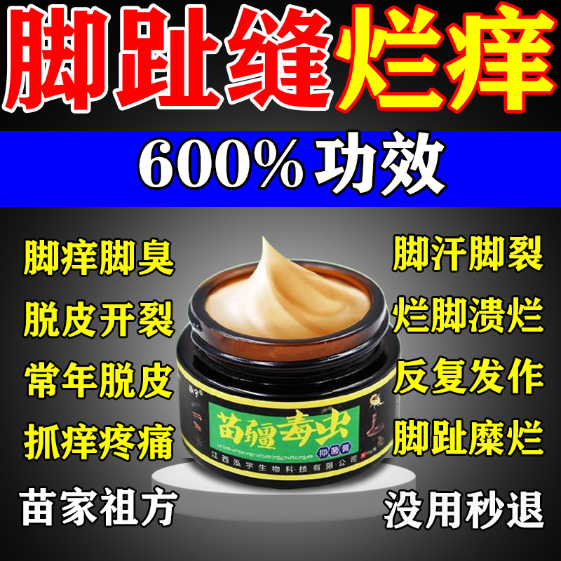 苗家祖方脚膏止痒气根去专用的药烂脚丫脱皮糜烂脚趾缝真菌感染膏