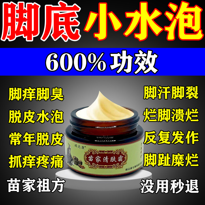 苗家祖方脚膏止痒气根去专用的药烂脚丫脱皮糜烂脚趾缝真菌感染膏