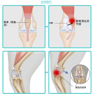 狗后双腿支撑架护膝适用撕裂 acl十字韧带髌骨支撑缓解关节疼痛