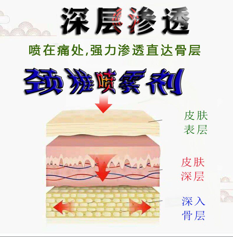 腱鞘手指炎手关痛手腕舒筋大拇指舒痛囊肿鼓包喷雾剂