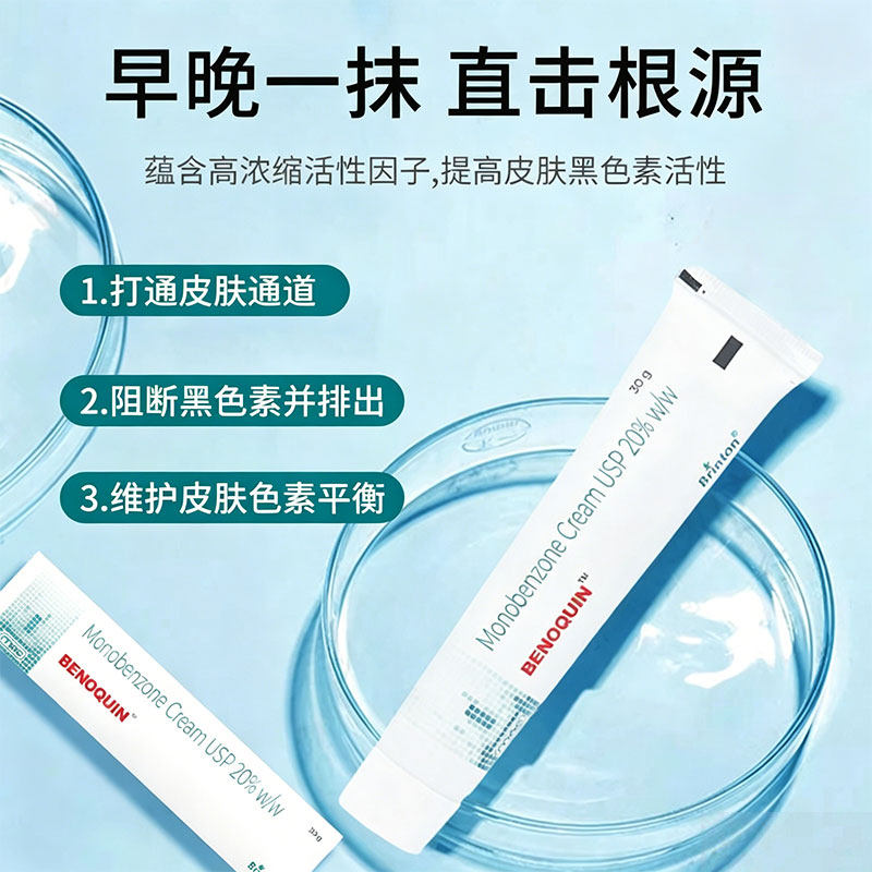Benoquin20%莫诺苯宗脱色膏原装进口白癜风脱色膏均衡肤色 30g/支