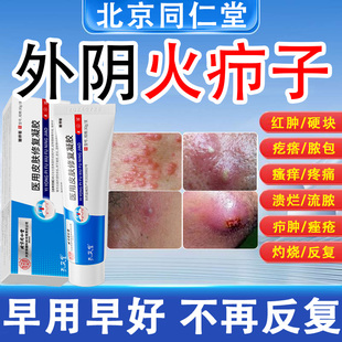 外阴火疖子硬块脓包疖肿拔毒脓皮脂腺囊肿药私处长痘痘敷料膏贴HX