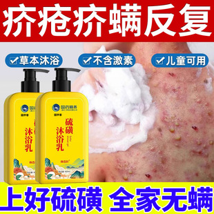 疥疮疥螨特治疥虫皮肤干燥瘙痒的药效杀虫剂硫磺阴囊结节沐浴露HX