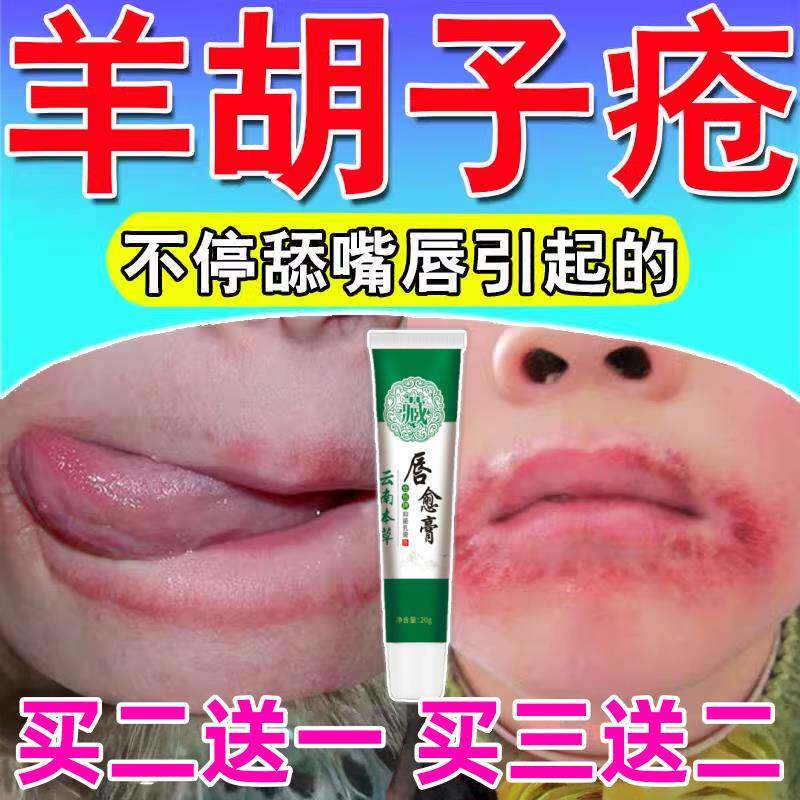 羊胡子疮小孩舔嘴巴干裂脱皮起泡软膏嘴唇口周焱上火烂嘴修复唇膏