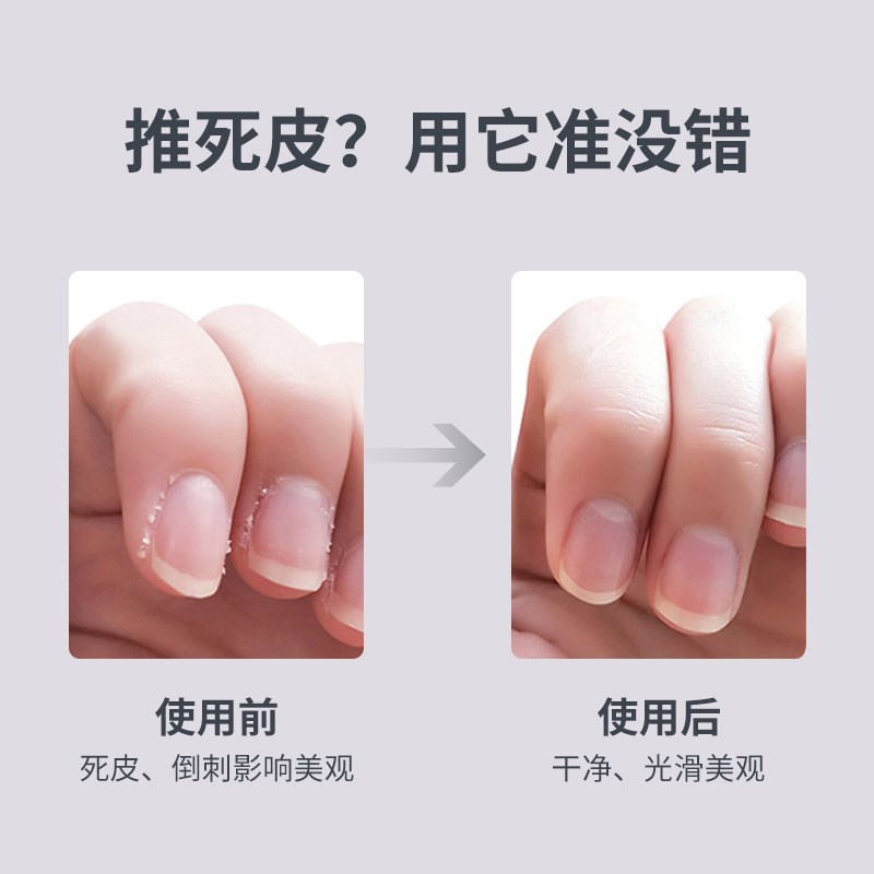 去死皮推叉去手指死皮铲不锈钢锋利修指甲边缘老茧推刀去角质工具