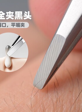 高精密粉刺夹小夹子黑头夹平口镊