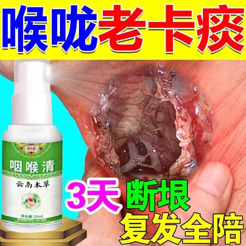 痰多吐不完粘嗓子不舒服老有痰喉咙干痒咳K嗽有异物痰液粘稠喷雾
