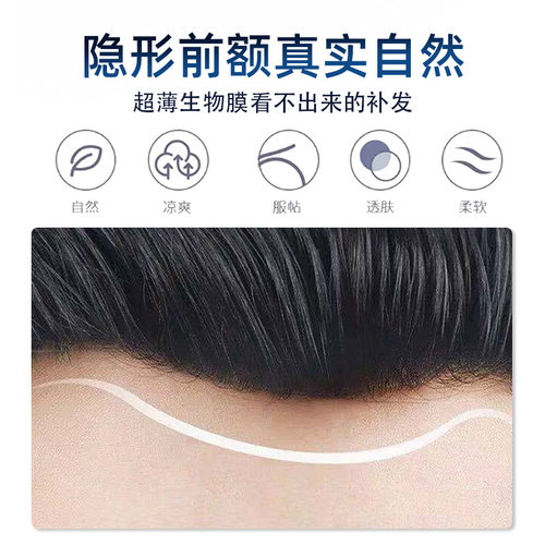 男士全手织点扣生物头皮假发男头顶补发片真发隐形无痕秃顶补发块