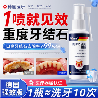 德国口腔科认证丨去牙石口臭第1