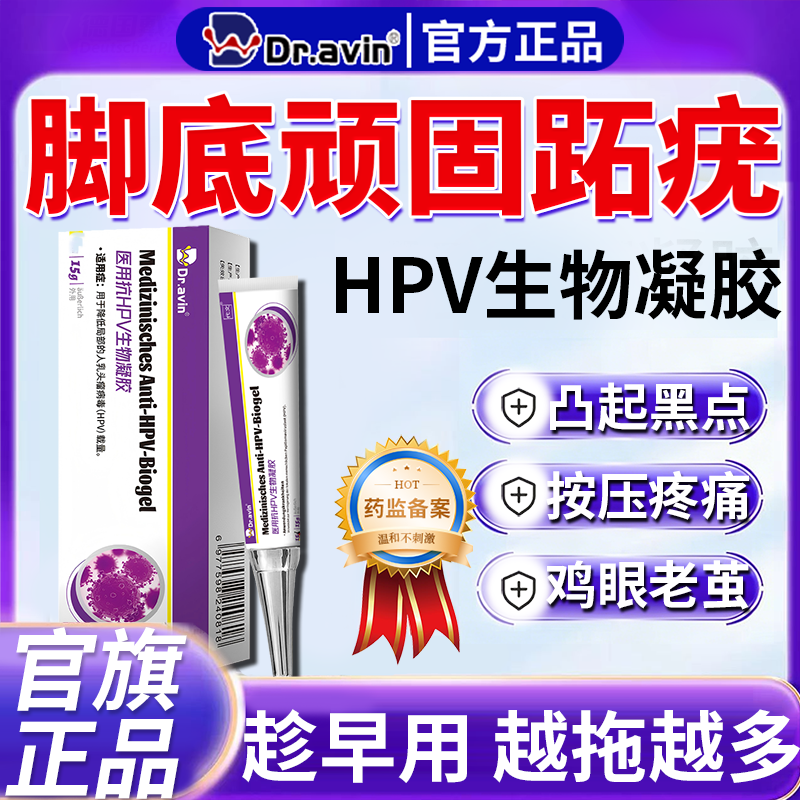 跖疣专用膏去足部脚底趾疣根病疣毒连拔除脚钉祛除膏鸡茧眼膏药CS
