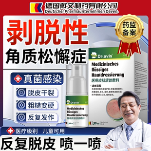 治疗剥脱性角质松懈症儿童手脱皮起皮的专用膏药贴真菌感染喷雾CS