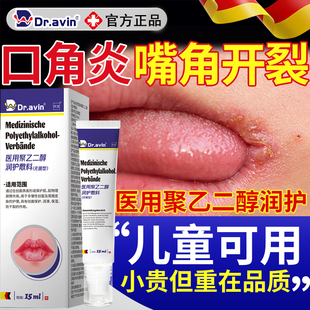 儿童口角炎烂嘴角开裂裂口干燥起皮唇炎唇膏嘴巴上火起泡搭药膏SE