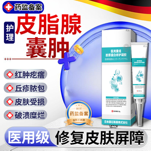 dr.avin皮脂腺囊肿膏粉瘤粉刺火疖子皮下痘痘硬块拔毒拔脓CS