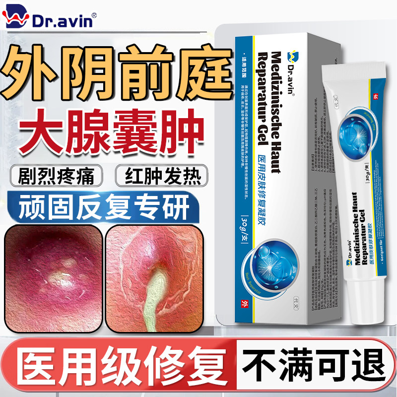 Dr.avin前庭大腺囊肿巴氏腺囊肿疏通外阴有疙瘩肿痛痘痘火疖子SE