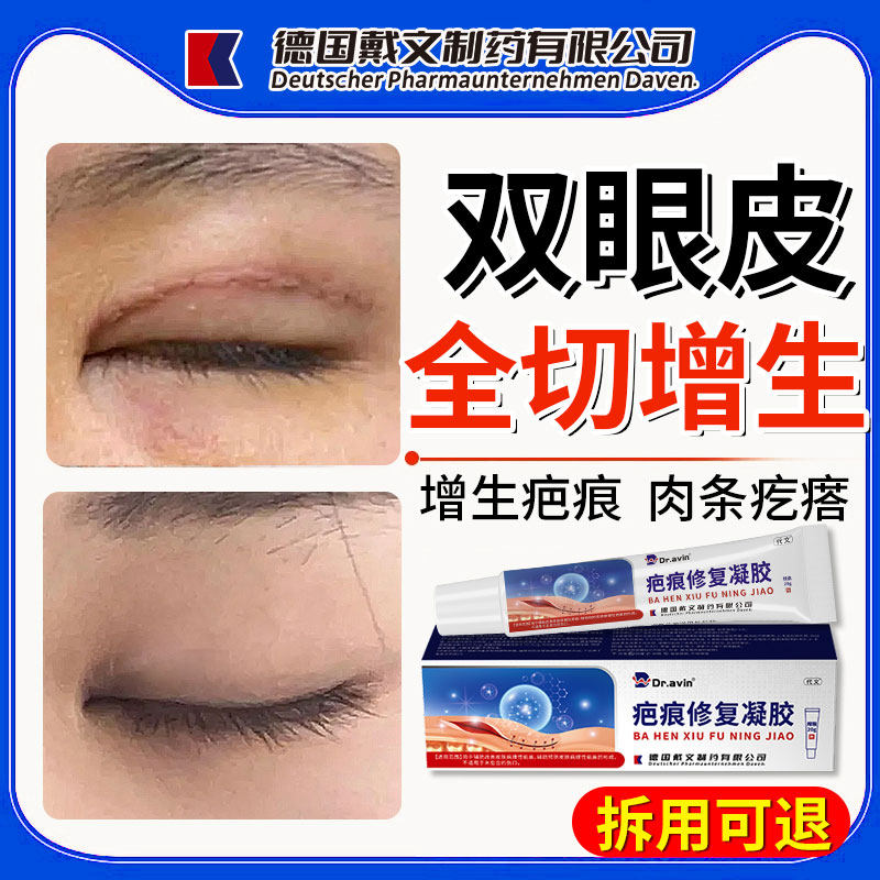 Dr.avin全切双眼皮割术后祛疤膏贴修复疤痕增生凸起去除疙瘩祛QQ,医疗器械,祛疤产品,淘宝优惠券,粉丝福利购,淘宝优惠卷