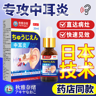 中耳外耳道炎专用耳朵痒真菌感染药消炎滴耳液进口治疗耳鸣