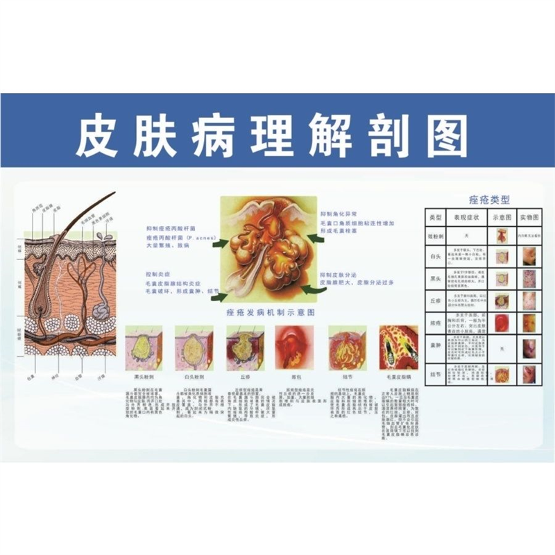 皮肤病理解剖图海报展板皮肤结构图黑色素的产生与通道墙贴墙纸,个性定制/设计服务/DIY,写真/海报印制,淘宝优惠券,粉丝福利购,淘宝优惠卷