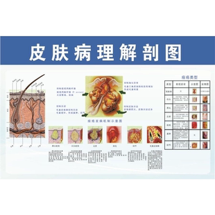 皮肤病理解剖图海报展板皮肤结构图黑色素的产生与通道墙贴墙纸