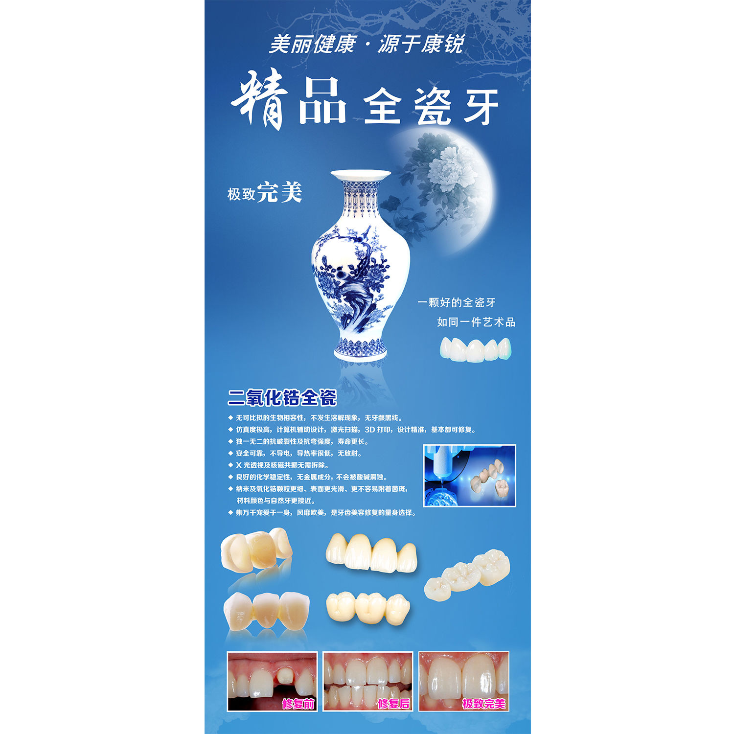 医院展板墙贴牙科挂图口腔宣传装饰画 二氧化锆全瓷牙齿海报贴画