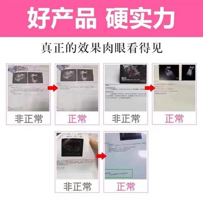【盆腔积液当晚排】盆腔积液中药贴输卵- 管堵塞宫腔粘连膏XN