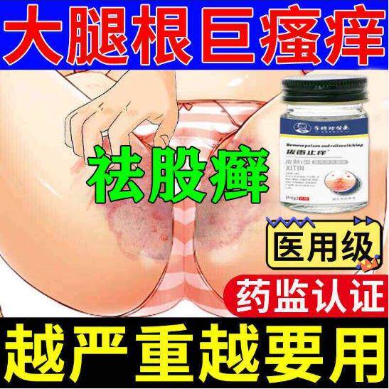 股癣私处皮肤湿痒专止真菌感染屁股湿疹大腿内侧瘙痒股癣症特膏ZT