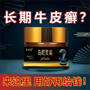 草本抑菌乳膏 老顽康乌蛇百毒线下门店五年热销款 牛皮藓专用