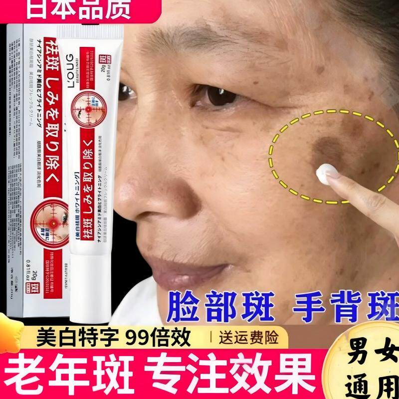 日本进口祛斑霜专治祛老年斑专用脸部去手上手部手背膏强力去除