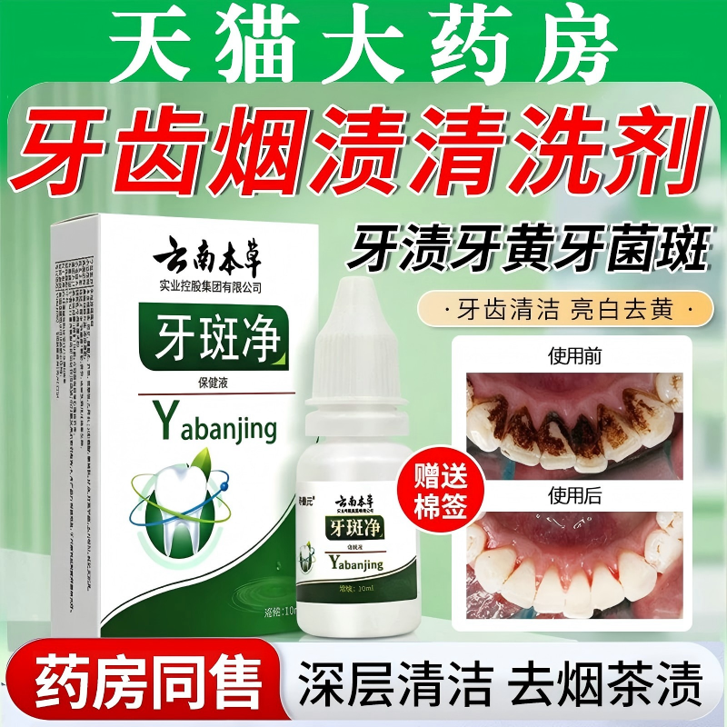牙齿烟渍清洗剂神器去黄牙渍牙垢洗牙液清洁亮白官方正品旗舰店