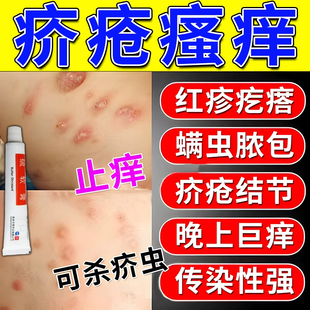疥疮膏疥疮特专用效药疥疮结节皮肤剧烈瘙痒丘疹水泡阴囊疥疮硫软