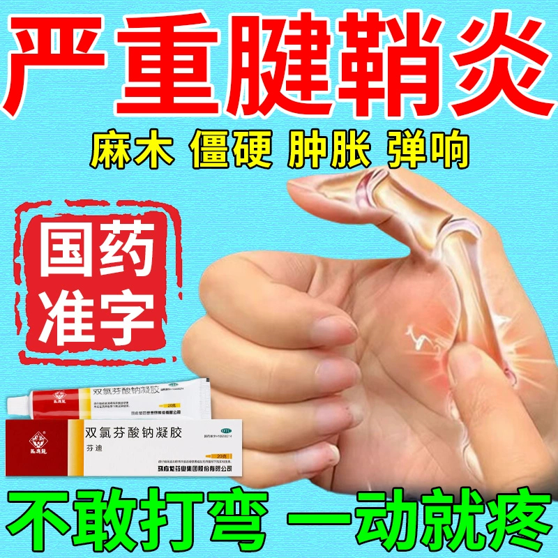马应龙腱鞘炎特新效药膏手指关节疼大拇指腱鞘炎双氯芬酸钠凝胶